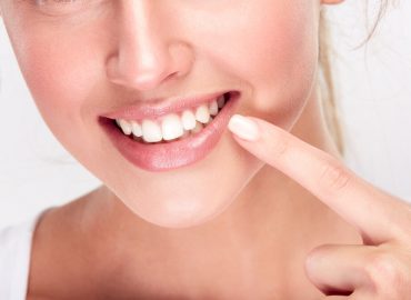 Održavanje zuba nakon beljenja