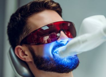Zašto se preporučuje ordinacijsko izbeljivanje zuba