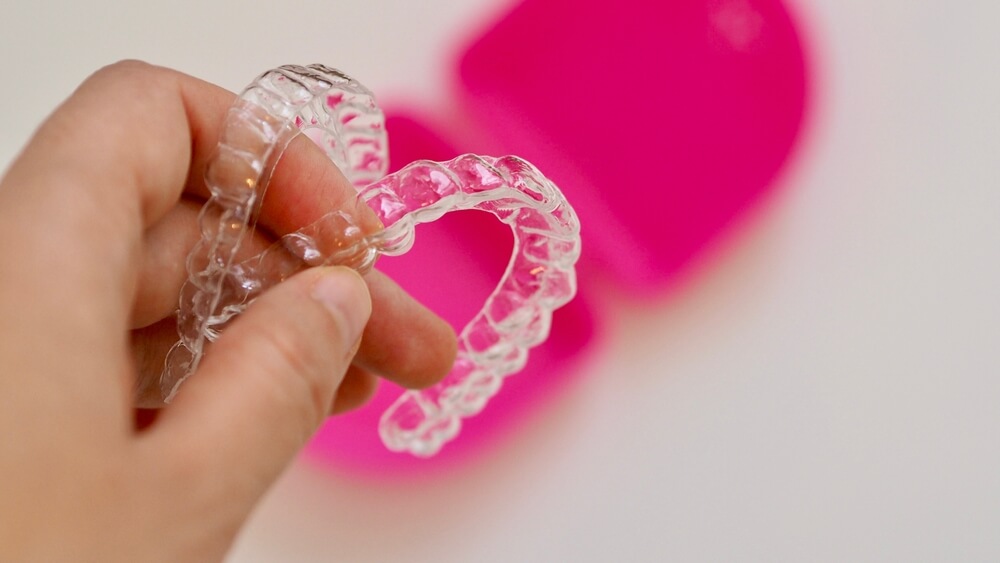 Ritejneri posle fiksne proteze