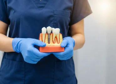 Da li ugradnja implantata boli? Sve što treba da znate pre intervencije